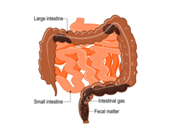 Constipation - Foundation for Female Health Awareness